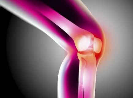 Deformation arthrosis