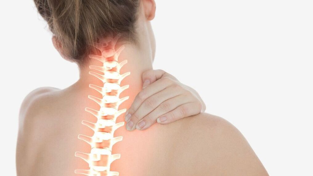 Neck pain due to osteochondrosis of the cervical spine