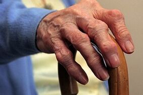Damage to the fingers with osteoarthritis